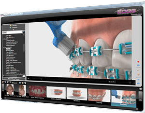Ortho2 Edge Reviews 2025: Details, Pricing, & Features | G2