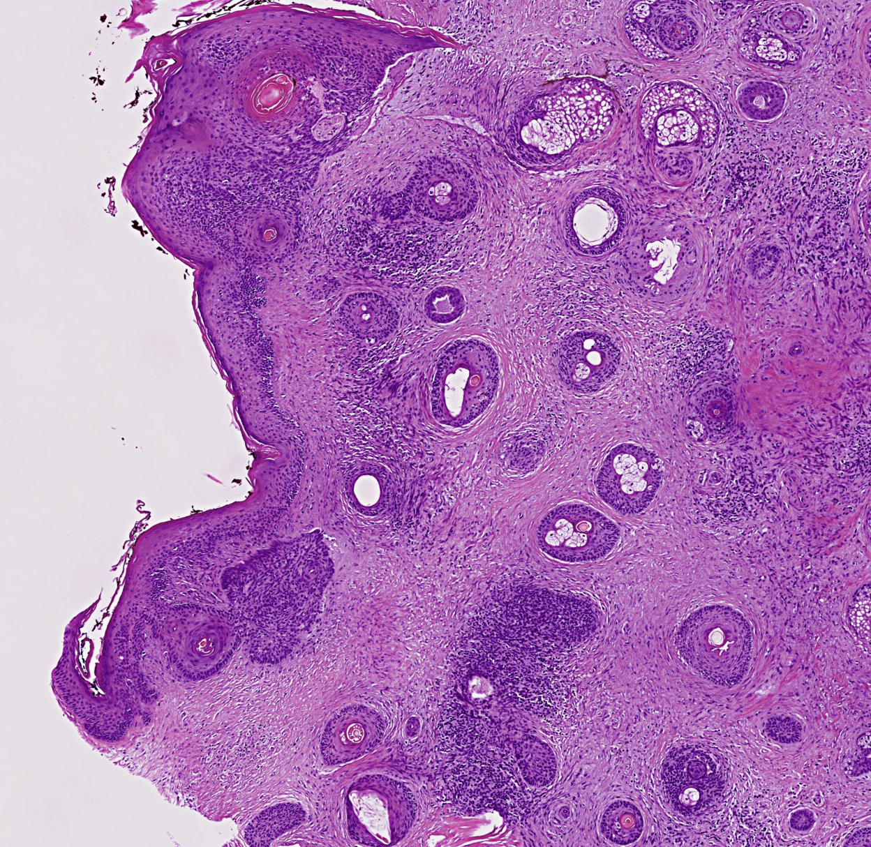 Direct-to-Digital Staining screenshot