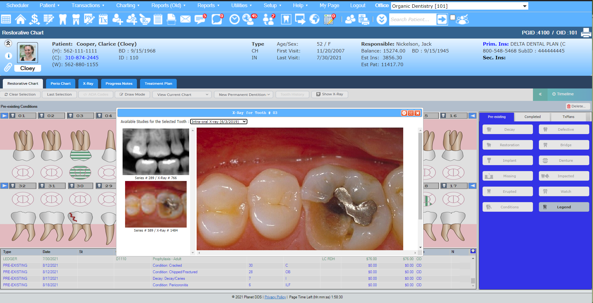 Denticon vs. Dentrix G2